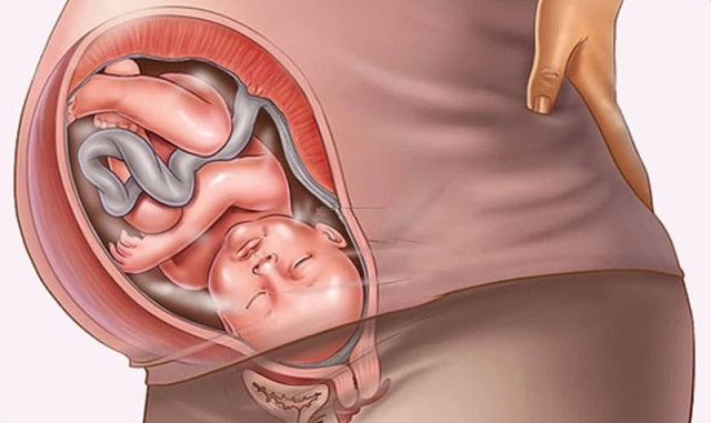 tư thế nằm của thai nhi trong bụng mẹ