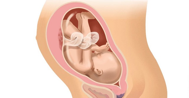 tư thế nằm của thai nhi trong bụng mẹtư thế nằm của thai nhi trong bụng mẹ
